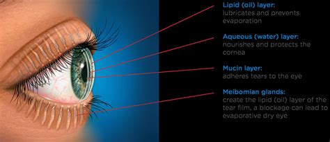 tear film instability